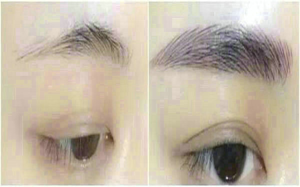 <a href=http://www.f3bb6.cn/listinfo-655-0.html target=_blank class=infotextkey>切眉</a>多久能紋眉?