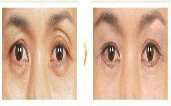 <a href=http://www.f3bb6.cn/listinfo-655-0.html target=_blank class=infotextkey>切眉</a>后多久能紋眉?