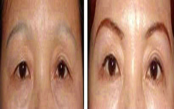 <a href=http://www.f3bb6.cn/listinfo-655-0.html target=_blank class=infotextkey>切眉</a>后多長時間紋眉?