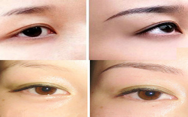 <a href=http://www.f3bb6.cn/listinfo-655-0.html target=_blank class=infotextkey>切眉</a>哪里做的好