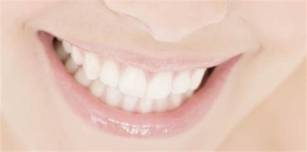 影響<a href=http://www.f3bb6.cn/listinfo-829-0.html target=_blank class=infotextkey>烤瓷牙</a>價格的主要因素