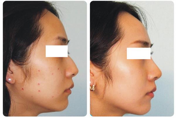 貴陽<a href=http://www.f3bb6.cn/listinfo-767-0.html target=_blank class=infotextkey>祛痣</a>費用