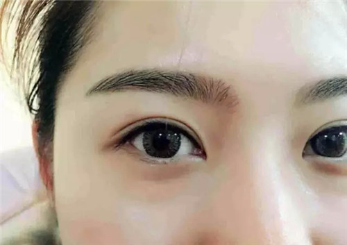 <a href=http://www.f3bb6.cn/listinfo-714-0.html target=_blank class=infotextkey>紋眼線</a>恢復過程圖