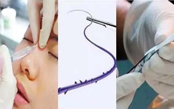 駱駝鼻整形的前提