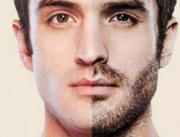 <a href=http://www.f3bb6.cn/listinfo-667-0.html target=_blank class=infotextkey>種植胡須</a>恢復(fù)時間