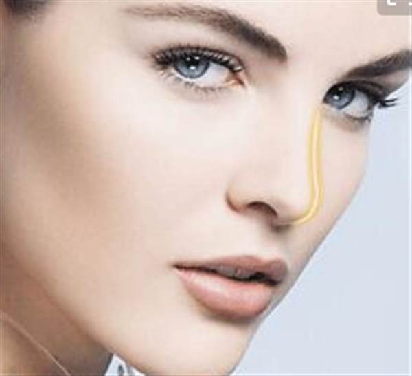 自體軟骨<a href=http://www.f3bb6.cn/listinfo-737-0.html target=_blank class=infotextkey>隆鼻</a>術后應該如何護理