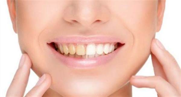 怎么治療牙黃口臭