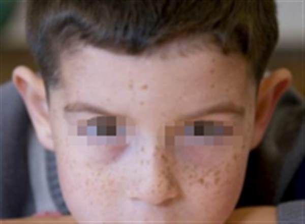 男士<a href=http://www.f3bb6.cn/listinfo-774-0.html target=_blank class=infotextkey>去雀斑</a>激光多少錢(qián)?