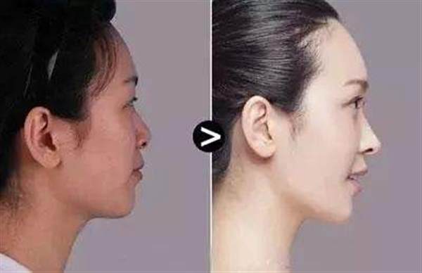 彩光<a href=http://www.f3bb6.cn/listinfo-770-0.html target=_blank class=infotextkey>嫩膚</a>主要有哪些特點(diǎn)