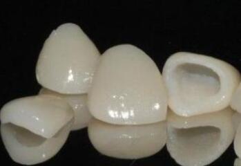 <a href=http://www.f3bb6.cn/listinfo-830-0.html target=_blank class=infotextkey>美容冠</a><a href=http://www.f3bb6.cn/listinfo-824-0.html target=_blank class=infotextkey>牙齒矯正</a>禁忌人群