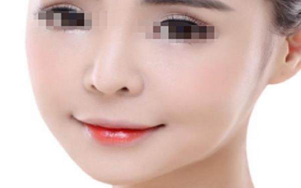 膨體多久取出較好?