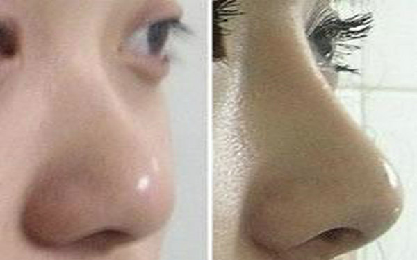 膨體是什么材料?