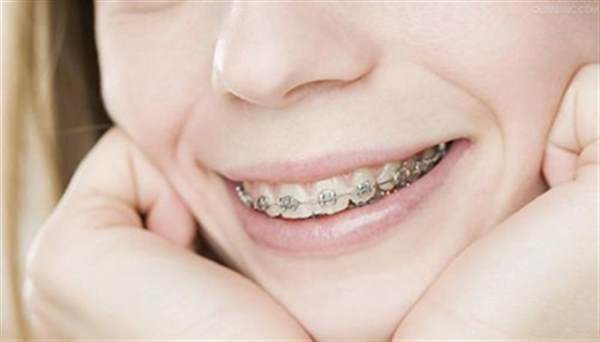 <a href=http://www.f3bb6.cn/listinfo-830-0.html target=_blank class=infotextkey>美容冠</a>的價錢受哪些因素的影響