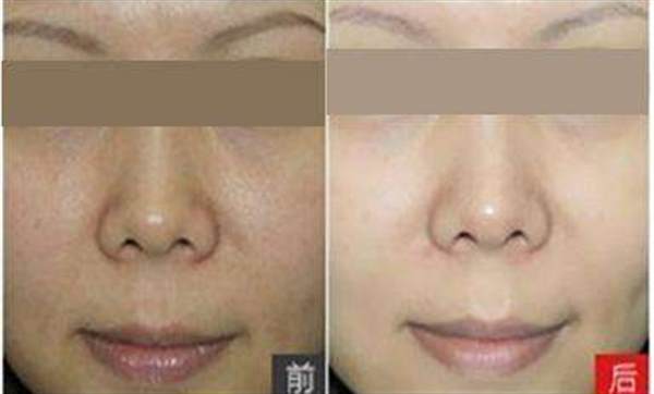 彩光<a href=http://www.f3bb6.cn/listinfo-770-0.html target=_blank class=infotextkey>嫩膚</a>美容有哪些好處