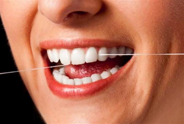 牙齒冷光美白會不會很貴