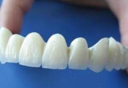 純鈦<a href=http://www.f3bb6.cn/listinfo-829-0.html target=_blank class=infotextkey>烤瓷牙</a>效果持續時間