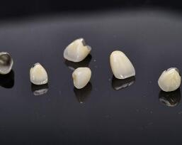 鈷鉻<a href=http://www.f3bb6.cn/listinfo-829-0.html target=_blank class=infotextkey>烤瓷牙</a>恢復時間