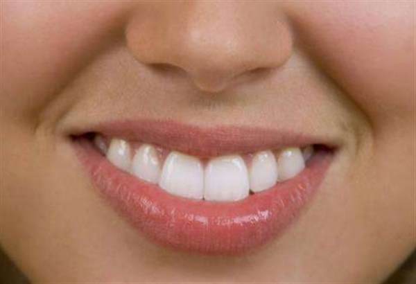 牙齒冷光美白的注意事項有哪些