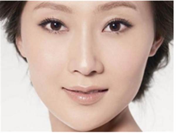 激光治療太田痣禁忌人群