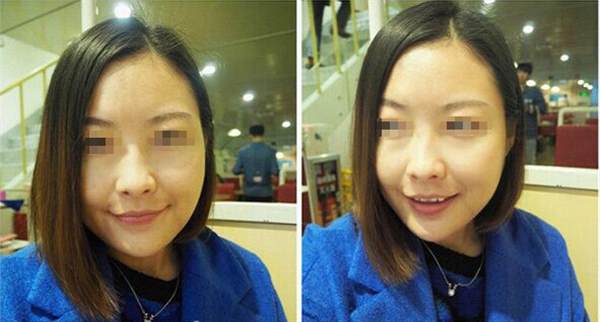 哪些人群不適合做光子<a href=http://www.f3bb6.cn/listinfo-770-0.html target=_blank class=infotextkey>嫩膚</a>呢