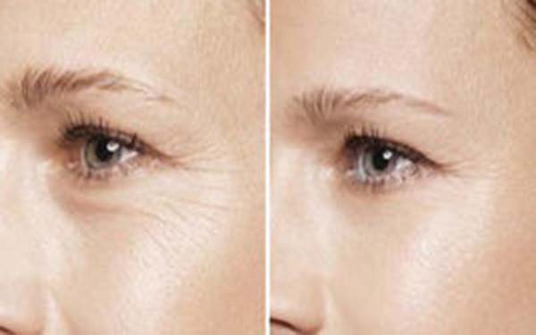 關于三點<a href=http://www.f3bb6.cn/listinfo-724-0.html target=_blank class=infotextkey>雙眼皮</a>的價格你知道多少？