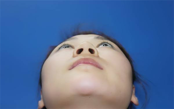 膨體<a href=http://www.f3bb6.cn/listinfo-737-0.html target=_blank class=infotextkey>隆鼻</a>術前術后的注意事項