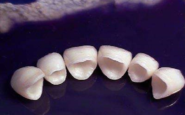 <a href=http://www.f3bb6.cn/listinfo-830-0.html target=_blank class=infotextkey>美容冠</a>副作用