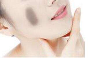 C6激光<a href=http://www.f3bb6.cn/listinfo-773-0.html target=_blank class=infotextkey>去胎記</a>效果好嗎