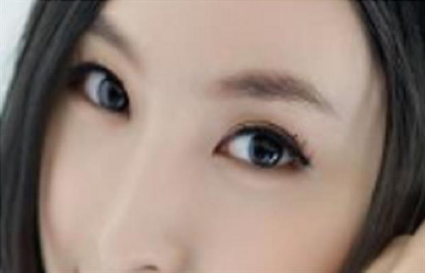 做<a href=http://www.f3bb6.cn/listinfo-650-0.html target=_blank class=infotextkey>眉部整形</a>術(shù)后如何注意護(hù)理