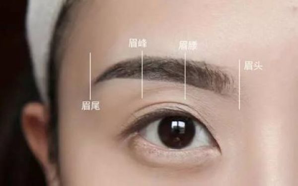 切開法重瞼術的手術要點和效果