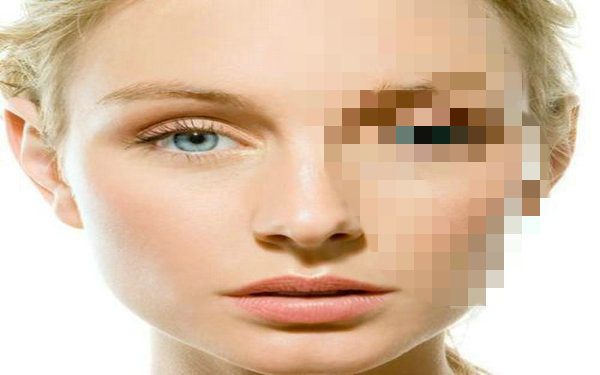 激光取痣會留疤嗎?