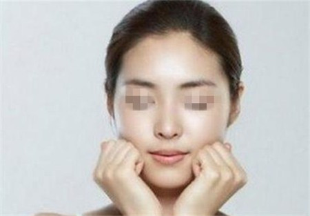 顴骨內推手術風險大嗎