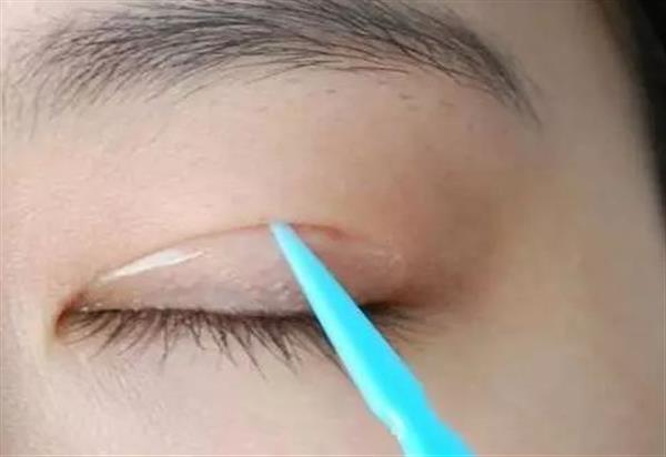 <a href=http://www.f3bb6.cn/listinfo-724-0.html target=_blank class=infotextkey>雙眼皮</a>貼貼久了會變<a href=http://www.f3bb6.cn/listinfo-724-0.html target=_blank class=infotextkey>雙眼皮</a>嗎