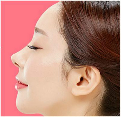 發際線后移原理