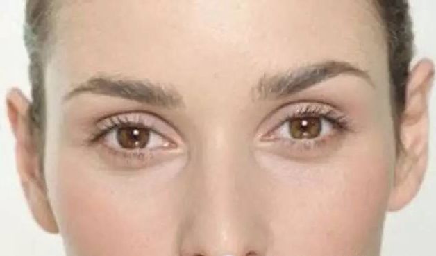 <a href=http://www.f3bb6.cn/listinfo-655-0.html target=_blank class=infotextkey>切眉</a>后增生了怎么辦