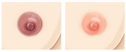 乳頭<a href=http://www.f3bb6.cn/listinfo-625-0.html target=_blank class=infotextkey>乳暈縮小</a>多少錢?