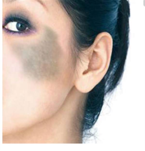 學生<a href=http://www.f3bb6.cn/listinfo-773-0.html target=_blank class=infotextkey>去胎記</a>要多少錢