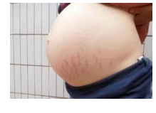 <a href=http://www.f3bb6.cn/listinfo-613-0.html target=_blank class=infotextkey>射頻</a><a href=http://www.f3bb6.cn/listinfo-791-0.html target=_blank class=infotextkey>去妊娠紋</a>價格