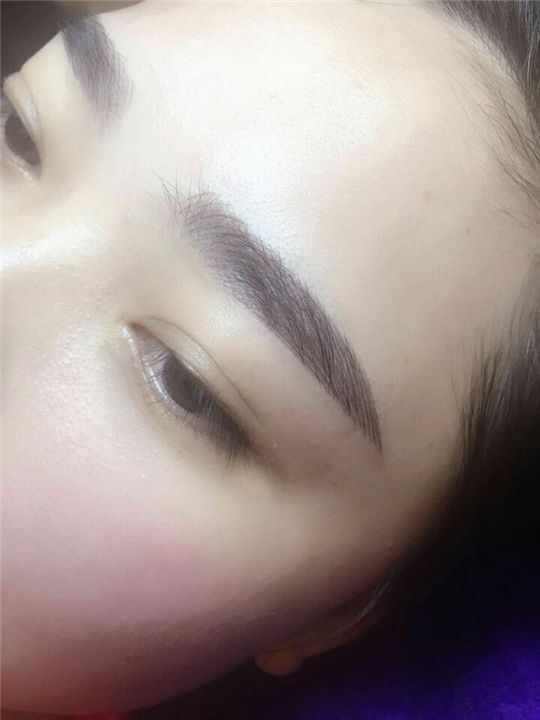 <a href=http://www.f3bb6.cn/listinfo-655-0.html target=_blank class=infotextkey>切眉</a>術前準備事項有哪些呢？