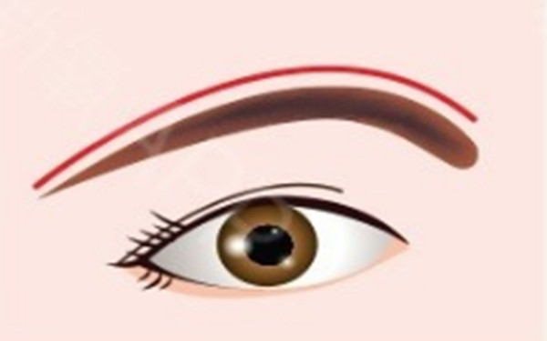 提眉術(shù)的手術(shù)設(shè)計操作怎樣?