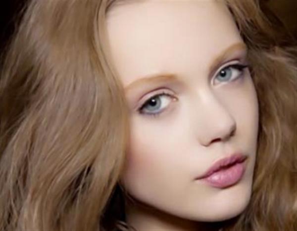 黃褐斑的治療注意事項有哪些