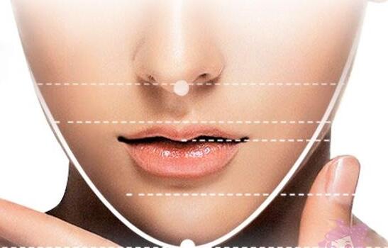 顴骨擴大術可用自體骨骼嗎?