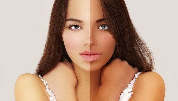 無錫鉆石光去除黃褐斑需要多久