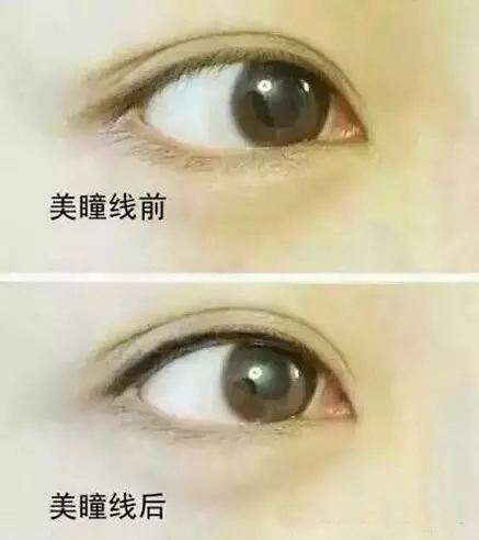 紋<a href=http://www.f3bb6.cn/listinfo-705-0.html target=_blank class=infotextkey>美瞳線</a>幾天能恢復