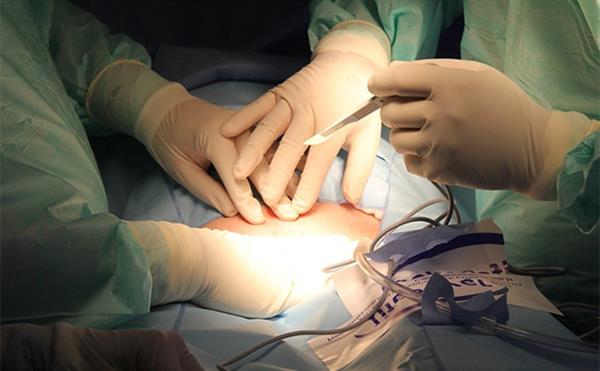 <a href=http://www.f3bb6.cn/listinfo-724-0.html target=_blank class=infotextkey>雙眼皮</a>埋線拆除能恢復(fù)嗎