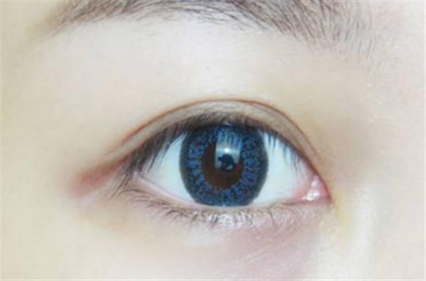 割<a href=http://www.f3bb6.cn/listinfo-724-0.html target=_blank class=infotextkey>雙眼皮</a>大概需要多久恢復