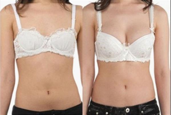 <a href=http://www.f3bb6.cn/listinfo-618-0.html target=_blank class=infotextkey>隆胸</a>后能母乳嗎