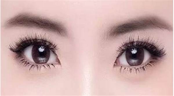 <a href=http://www.f3bb6.cn/listinfo-724-0.html target=_blank class=infotextkey>雙眼皮</a>變單眼皮可以通過哪些手術(shù)方式