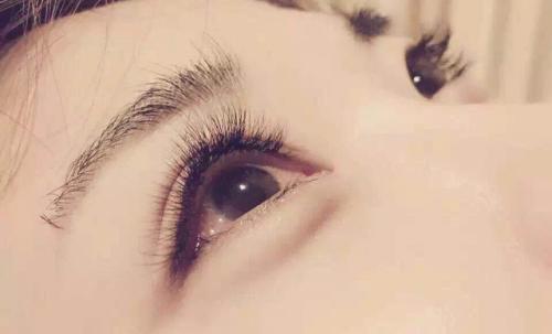 全切<a href=http://www.f3bb6.cn/listinfo-724-0.html target=_blank class=infotextkey>雙眼皮</a>手術(shù)的恢復(fù)時間