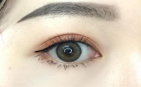 多眼皮怎么變回<a href=http://www.f3bb6.cn/listinfo-724-0.html target=_blank class=infotextkey>雙眼皮</a>的方法有哪些